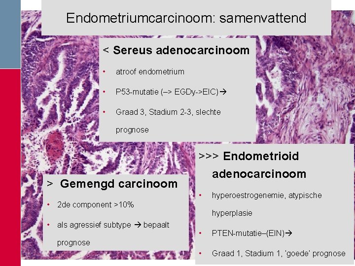 Endometriumcarcinoom: samenvattend < Sereus adenocarcinoom • atroof endometrium • P 53 -mutatie (–> EGDy->EIC) Endometriumcarcinoom: samenvattend < Sereus adenocarcinoom • atroof endometrium • P 53 -mutatie (–> EGDy->EIC)