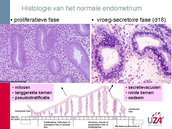 Histologie van het normale endometrium • proliferatieve fase • vroeg-secretoire fase (d 18) library. Histologie van het normale endometrium • proliferatieve fase • vroeg-secretoire fase (d 18) library.