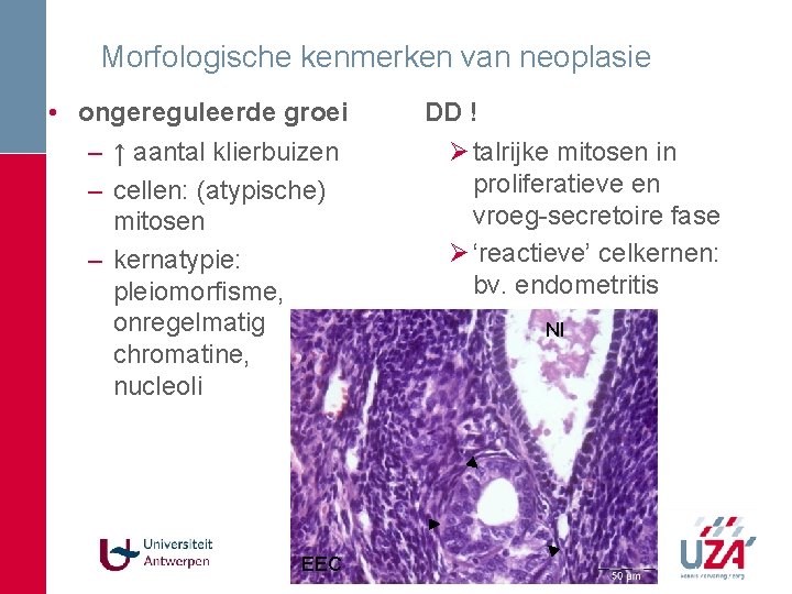 Morfologische kenmerken van neoplasie • ongereguleerde groei – ↑ aantal klierbuizen – cellen: (atypische) Morfologische kenmerken van neoplasie • ongereguleerde groei – ↑ aantal klierbuizen – cellen: (atypische)