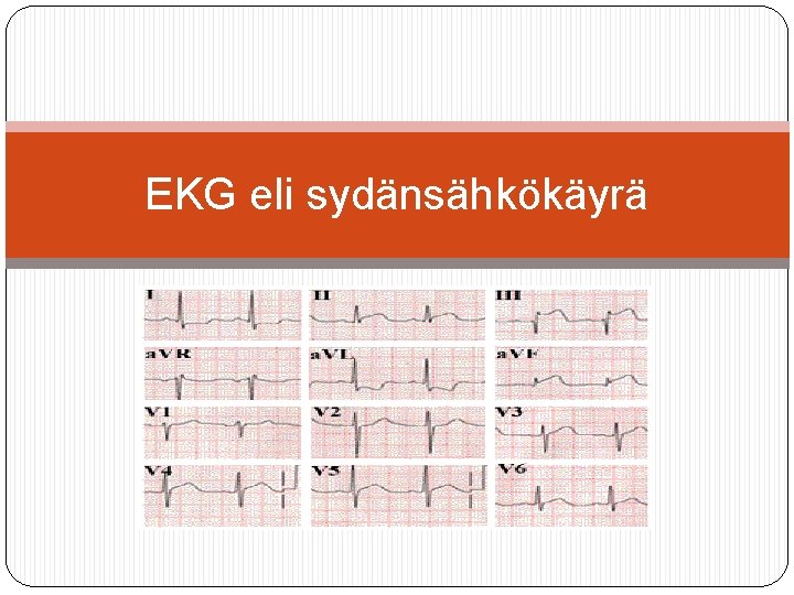 EKG eli sydänsähkökäyrä 