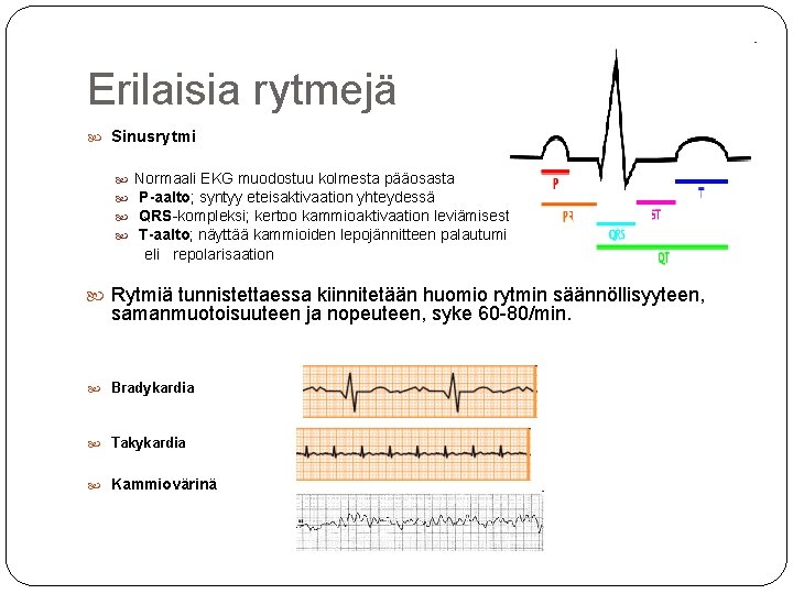 Erilaisia rytmejä Sinusrytmi Normaali EKG muodostuu kolmesta pääosasta P-aalto; syntyy eteisaktivaation yhteydessä QRS-kompleksi; kertoo