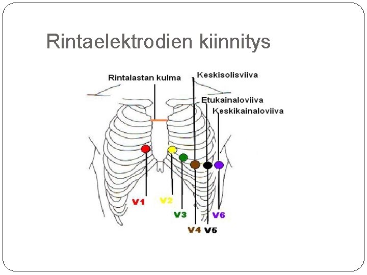 Rintaelektrodien kiinnitys 