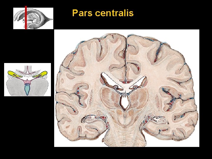 Pars centralis 