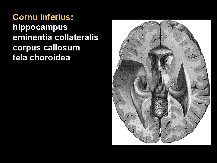 Cornu inferius: hippocampus eminentia collateralis corpus callosum tela choroidea 