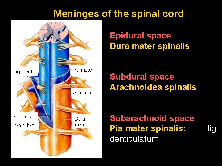 Meninges of the spinal cord Epidural space Dura mater spinalis Lig. dent. Pia mater