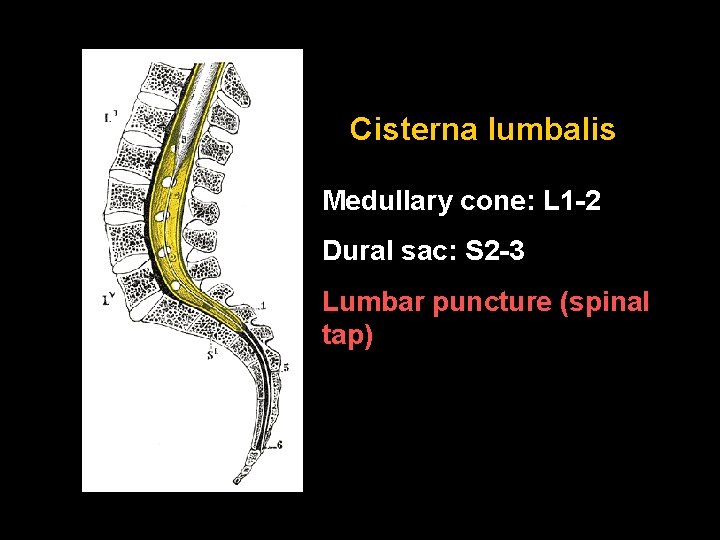 Cisterna lumbalis Medullary cone: L 1 -2 Dural sac: S 2 -3 Lumbar puncture