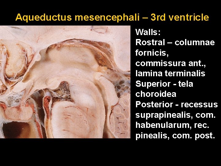 Aqueductus mesencephali – 3 rd ventricle Walls: Rostral – columnae fornicis, commissura ant. ,