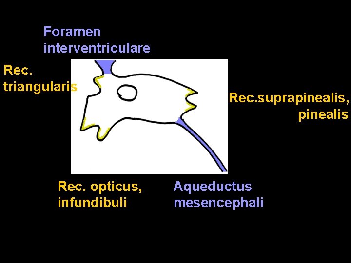 Foramen interventriculare Rec. triangularis Rec. opticus, infundibuli Rec. suprapinealis, pinealis Aqueductus mesencephali 