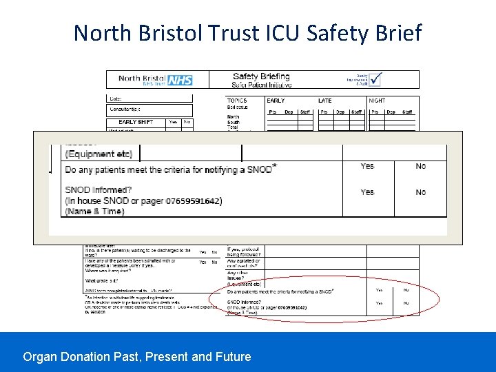 North Bristol Trust ICU Safety Brief Organ Donation Past, Present and Future North Bristol Trust ICU Safety Brief Organ Donation Past, Present and Future