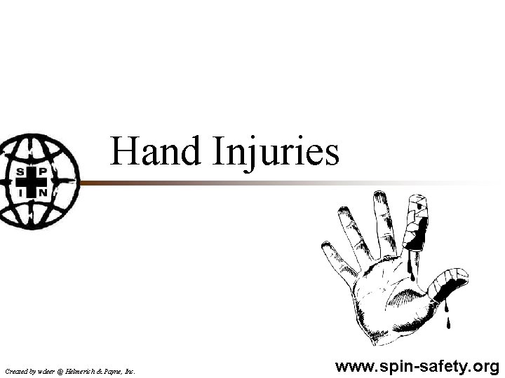 Hand Injuries Created by wdeer @ Helmerich & Payne, Inc. www. spin-safety. org 
