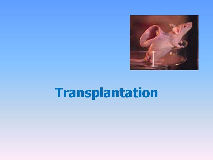 Transplantation 