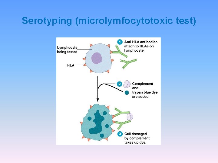 Serotyping (microlymfocytotoxic test) Serotyping (microlymfocytotoxic test)