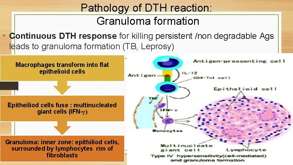 Pathology of DTH reaction: Granuloma formation • Continuous DTH response for killing persistent /non