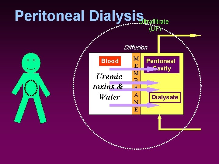 Peritoneal Dialysis. Ultrafiltrate (UF) Diffusion Blood Uremic toxins & Water M E M B