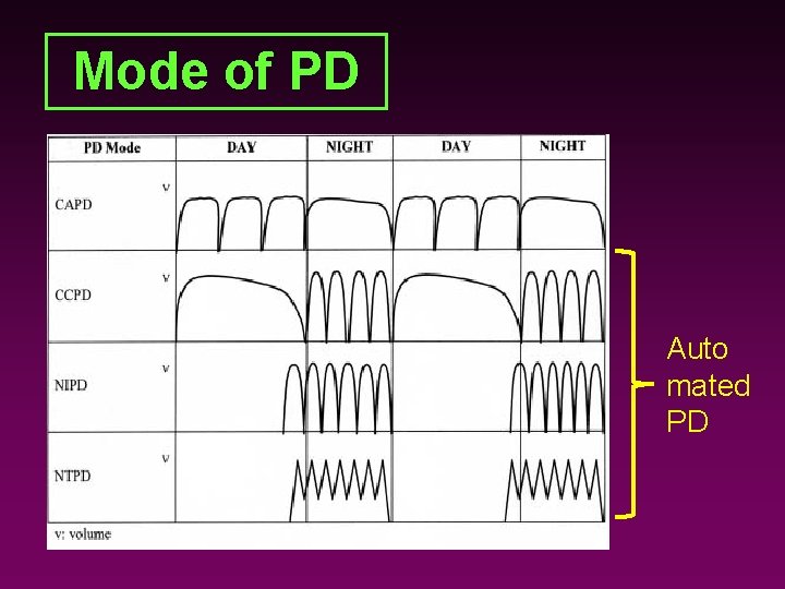 Mode of PD Auto mated PD 