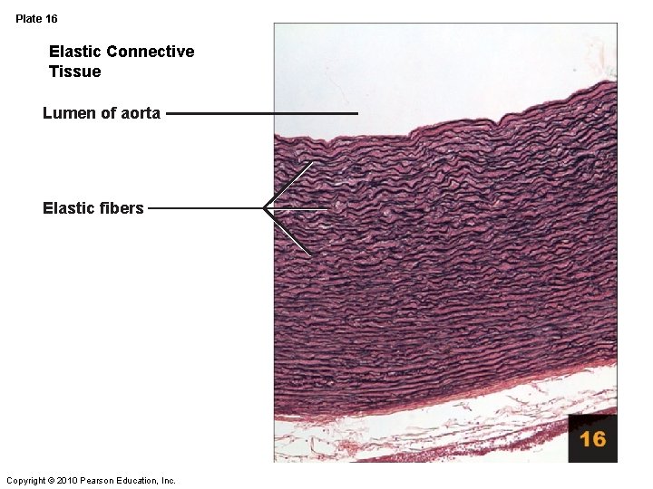 Plate 16 Elastic Connective Tissue Lumen of aorta Elastic fibers Copyright © 2010 Pearson