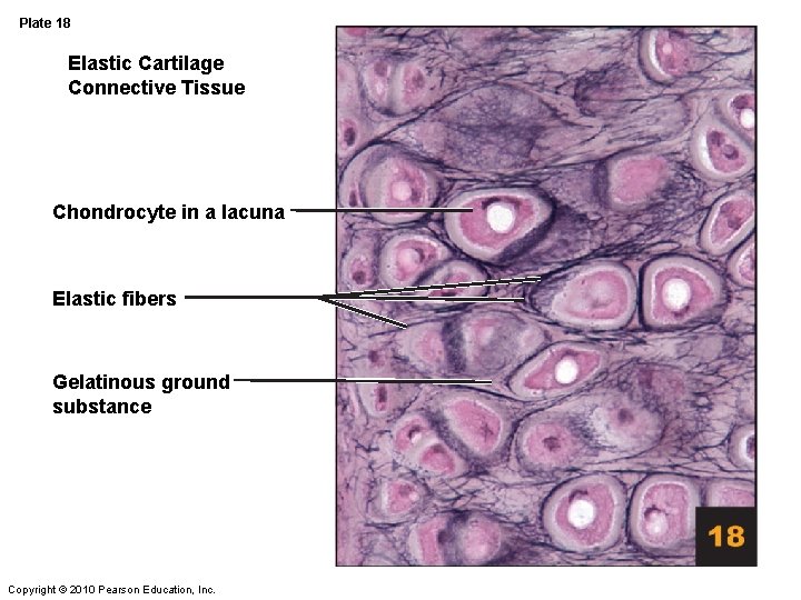 Plate 18 Elastic Cartilage Connective Tissue Chondrocyte in a lacuna Elastic fibers Gelatinous ground