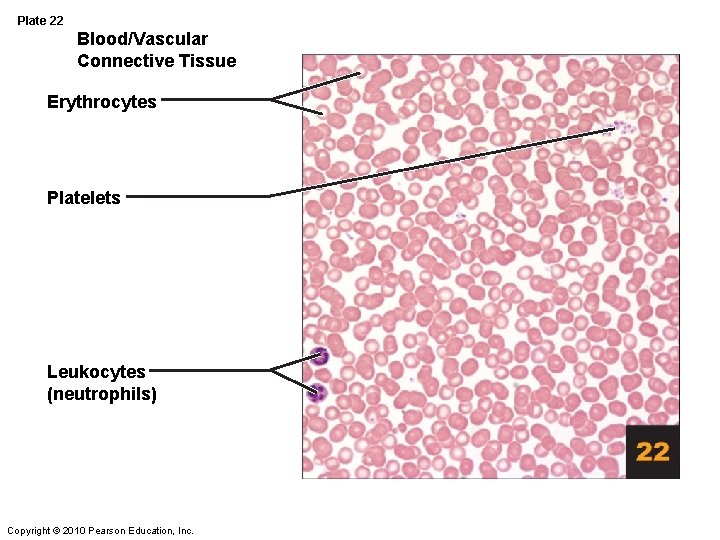 Plate 22 Blood/Vascular Connective Tissue Erythrocytes Platelets Leukocytes (neutrophils) Copyright © 2010 Pearson Education,