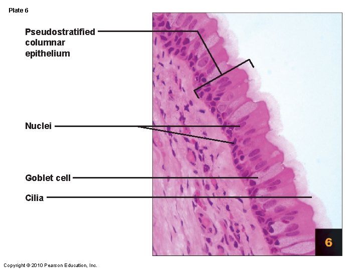 Plate 6 Pseudostratified columnar epithelium Nuclei Goblet cell Cilia Copyright © 2010 Pearson Education, Plate 6 Pseudostratified columnar epithelium Nuclei Goblet cell Cilia Copyright © 2010 Pearson Education,