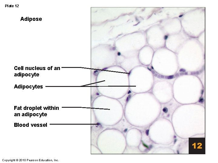 Plate 12 Adipose Cell nucleus of an adipocyte Adipocytes Fat droplet within an adipocyte