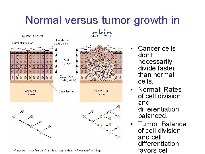 Normal versus tumor growth in skin • Cancer cells don’t necessarily divide faster than