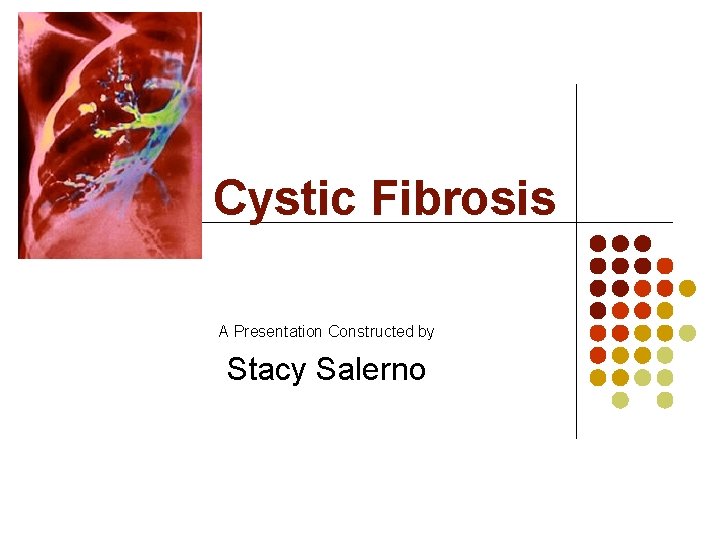 Cystic Fibrosis A Presentation Constructed by Stacy Salerno 