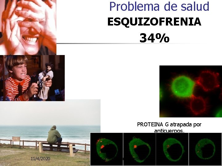 Problema de salud ESQUIZOFRENIA 34% PROTEINA G atrapada por anticuerpos. 11/4/2020 Dr. Roberto Inchaustegui Problema de salud ESQUIZOFRENIA 34% PROTEINA G atrapada por anticuerpos. 11/4/2020 Dr. Roberto Inchaustegui