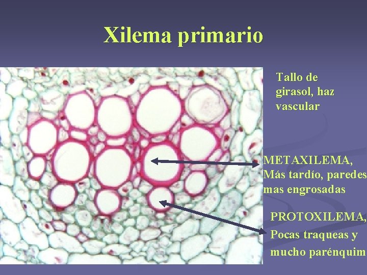 Xilema primario Tallo de girasol, haz vascular METAXILEMA, Más tardío, paredes mas engrosadas PROTOXILEMA, Xilema primario Tallo de girasol, haz vascular METAXILEMA, Más tardío, paredes mas engrosadas PROTOXILEMA,