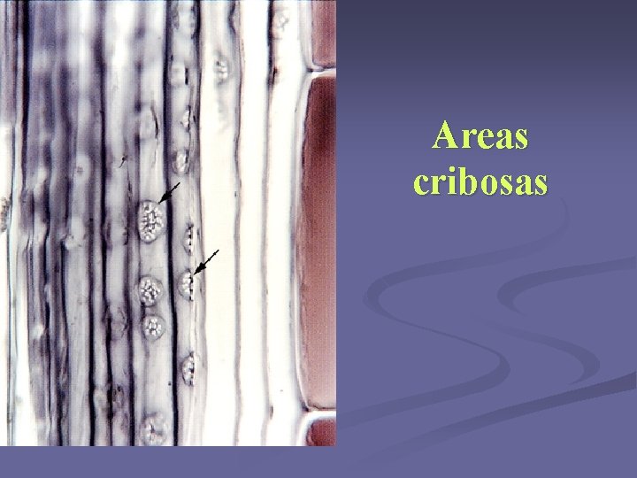 Areas cribosas Areas cribosas