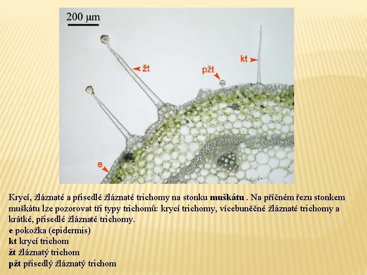 Krycí, žláznaté a přisedlé žláznaté trichomy na stonku muškátu. Na příčném řezu stonkem muškátu