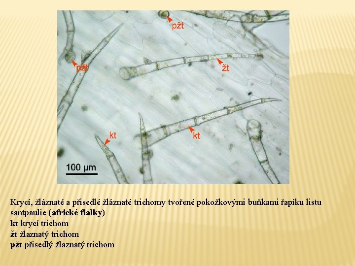 Krycí, žláznaté a přisedlé žláznaté trichomy tvořené pokožkovými buňkami řapíku listu santpaulie (africké fialky)