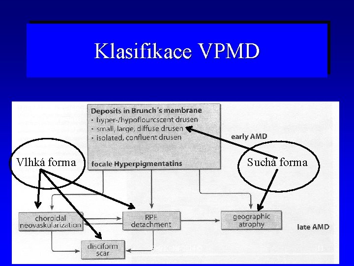 Klasifikace VPMD Vlhká forma Suchá forma Petr Kolář 2014 © 11 