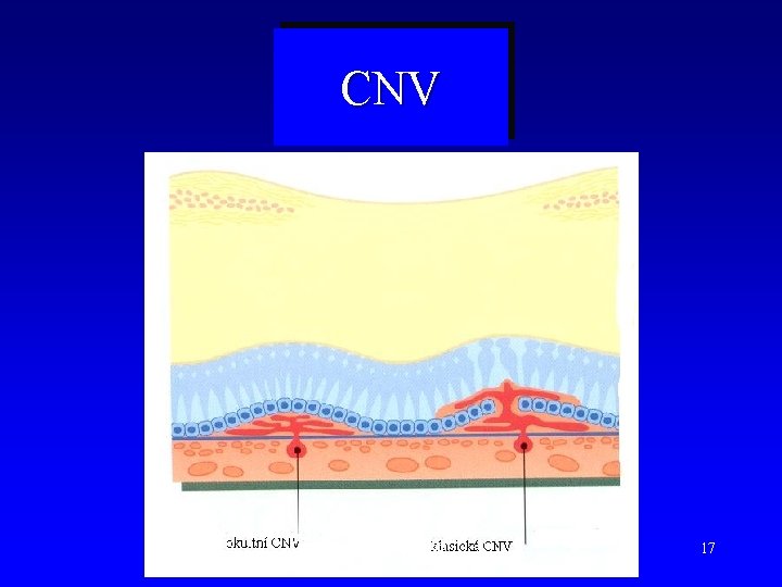 CNV Petr Kolář 2014 © 17 