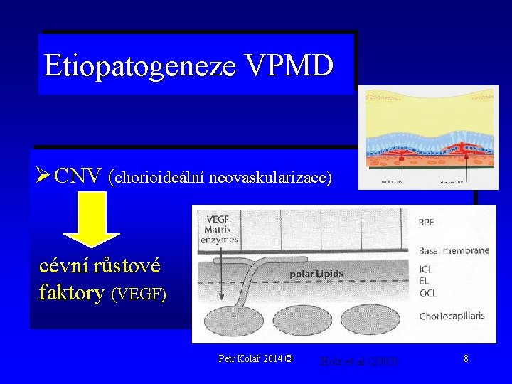 Etiopatogeneze VPMD Ø CNV (chorioideální neovaskularizace) cévní růstové faktory (VEGF) Petr Kolář 2014 ©