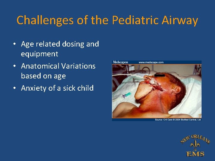 Challenges of the Pediatric Airway • Age related dosing and equipment • Anatomical Variations Challenges of the Pediatric Airway • Age related dosing and equipment • Anatomical Variations
