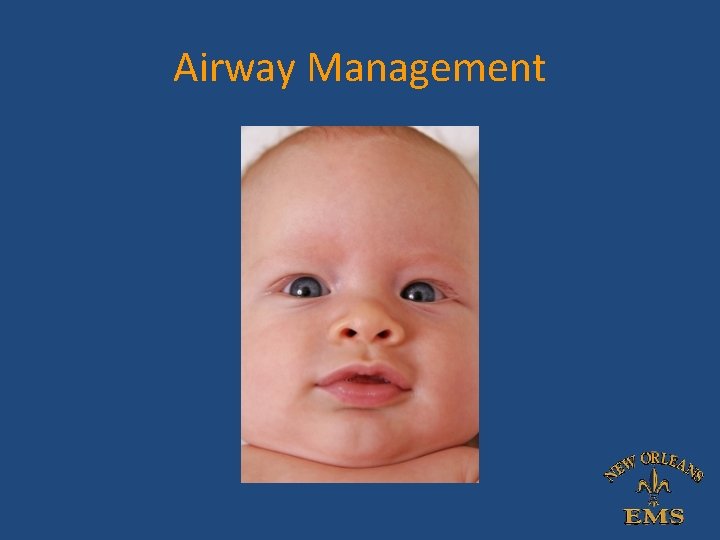 Airway Management Airway Management