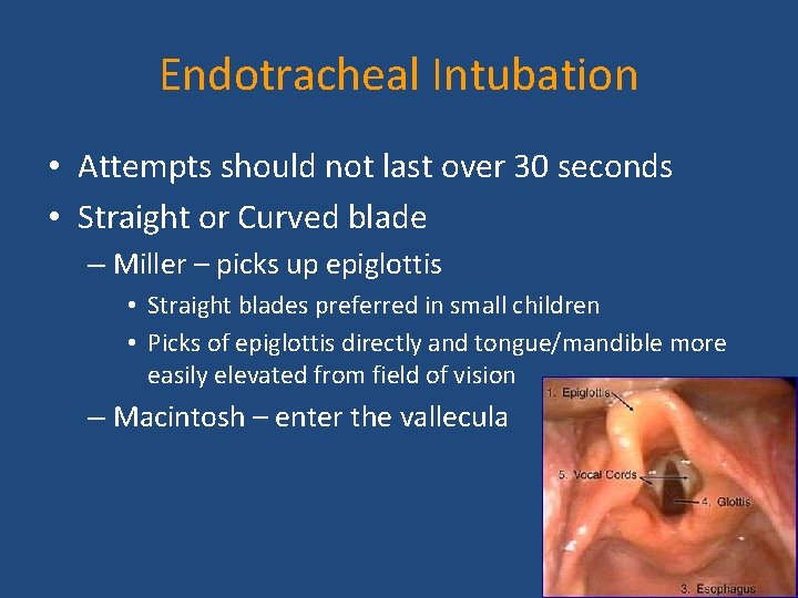 Endotracheal Intubation • Attempts should not last over 30 seconds • Straight or Curved Endotracheal Intubation • Attempts should not last over 30 seconds • Straight or Curved