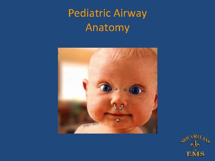Pediatric Airway Anatomy Pediatric Airway Anatomy