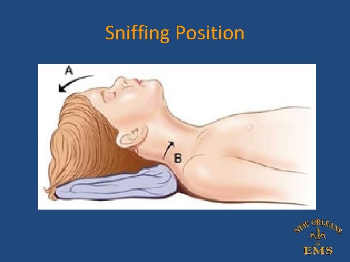 Sniffing Position Sniffing Position