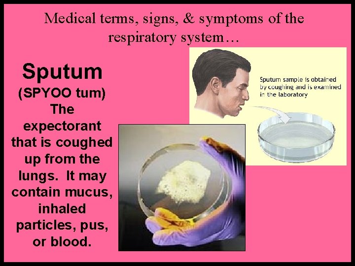 Medical terms, signs, & symptoms of the respiratory system… Sputum (SPYOO tum) The expectorant