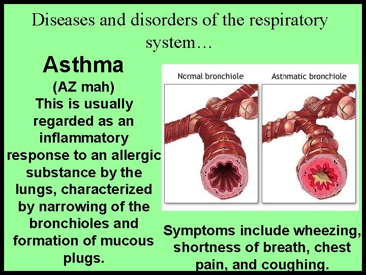 Diseases and disorders of the respiratory system… Asthma (AZ mah) This is usually regarded