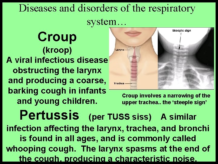 Diseases and disorders of the respiratory system… Croup (kroop) A viral infectious disease obstructing