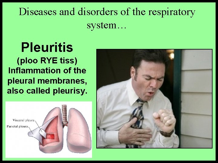 Diseases and disorders of the respiratory system… Pleuritis (ploo RYE tiss) Inflammation of the