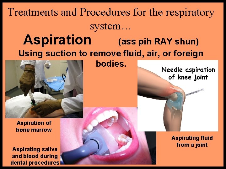 Treatments and Procedures for the respiratory system… Aspiration (ass pih RAY shun) Using suction