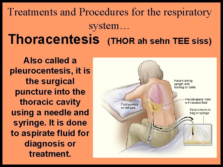Treatments and Procedures for the respiratory system… Thoracentesis Also called a pleurocentesis, it is