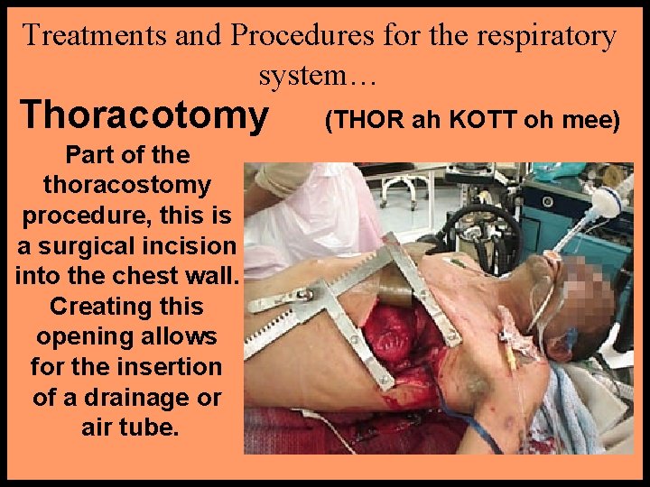 Treatments and Procedures for the respiratory system… Thoracotomy Part of the thoracostomy procedure, this
