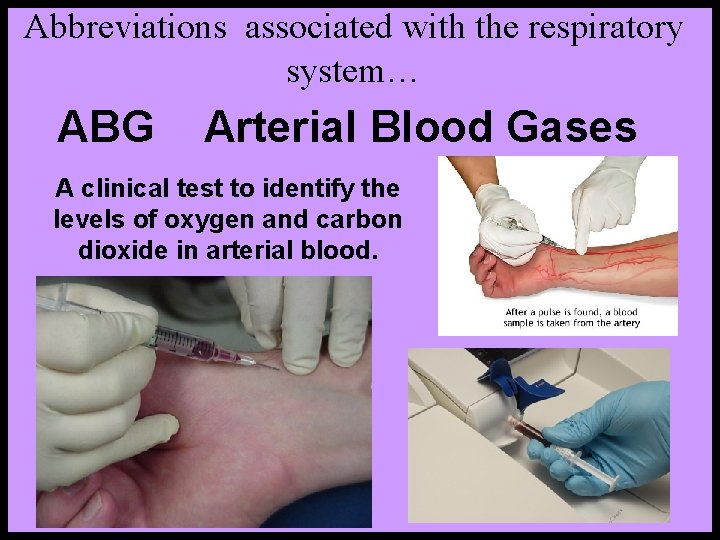 Abbreviations associated with the respiratory system… ABG Arterial Blood Gases A clinical test to