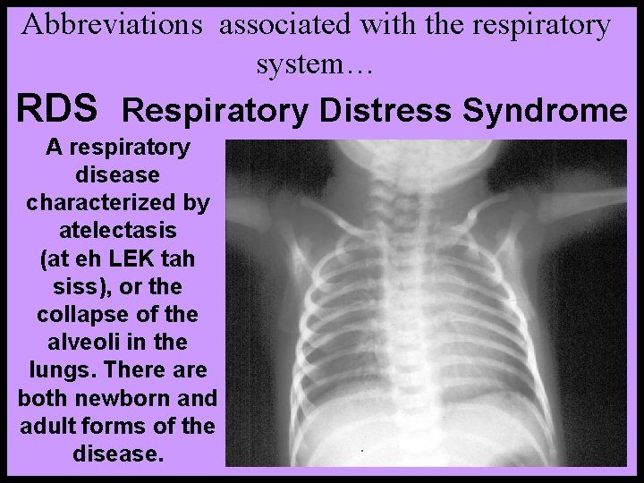 Abbreviations associated with the respiratory system… RDS Respiratory Distress Syndrome A respiratory disease characterized