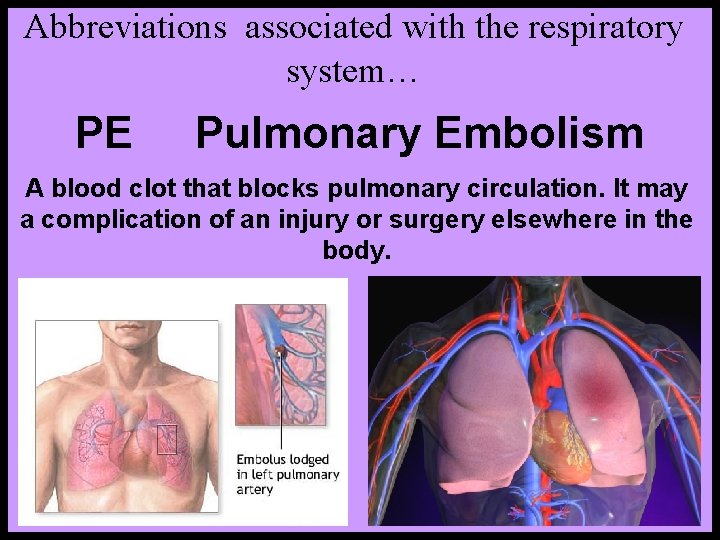 Abbreviations associated with the respiratory system… PE Pulmonary Embolism A blood clot that blocks
