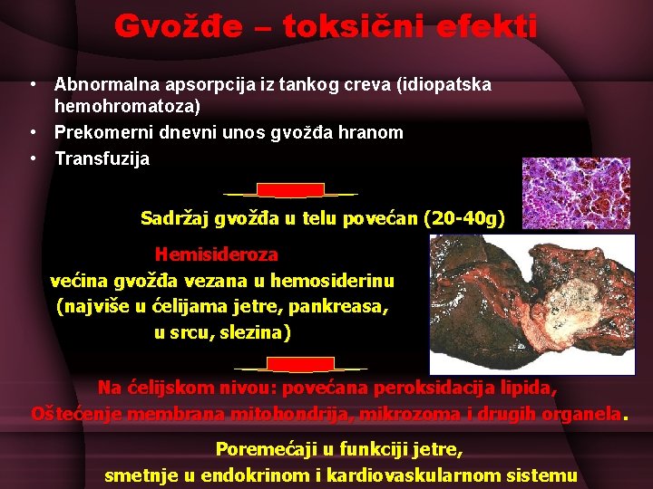 Gvožđe – toksični efekti • Abnormalna apsorpcija iz tankog creva (idiopatska hemohromatoza) • Prekomerni